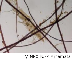 桑の繊維顕微鏡写真
